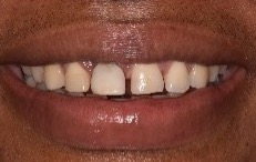 smile gallery image