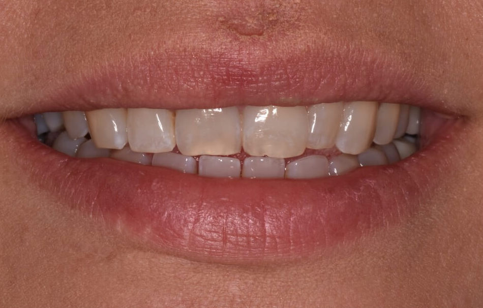 smile gallery image
