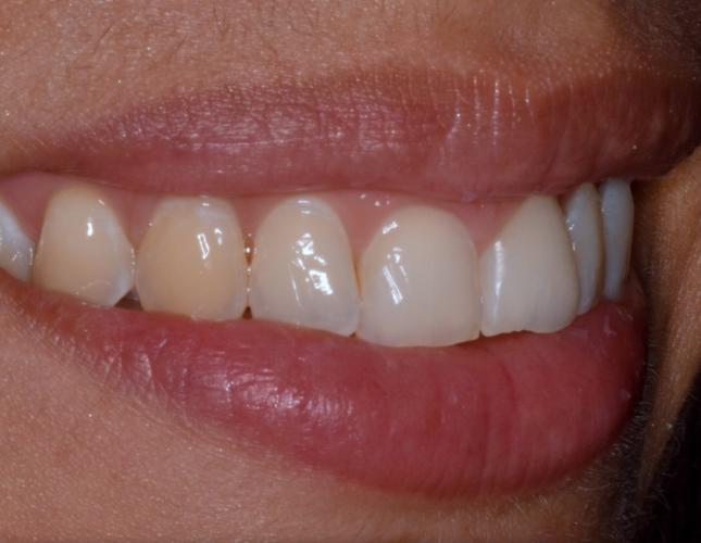 before image