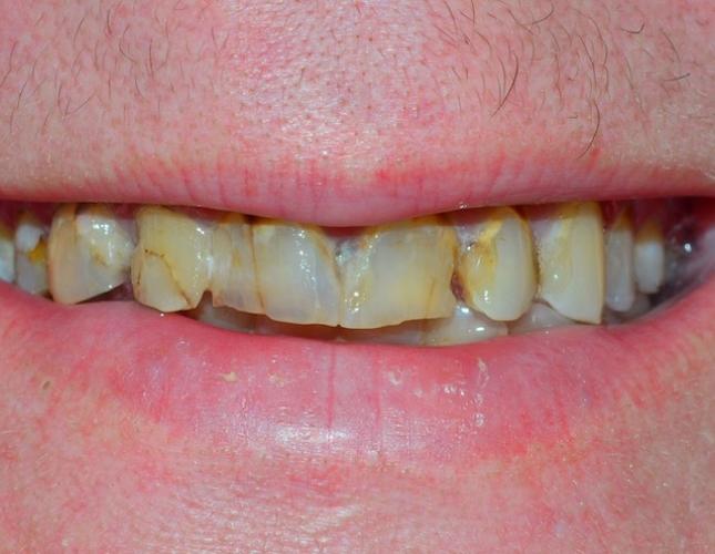 before image 