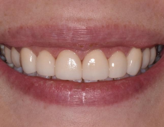 after image