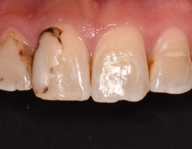 before image before image