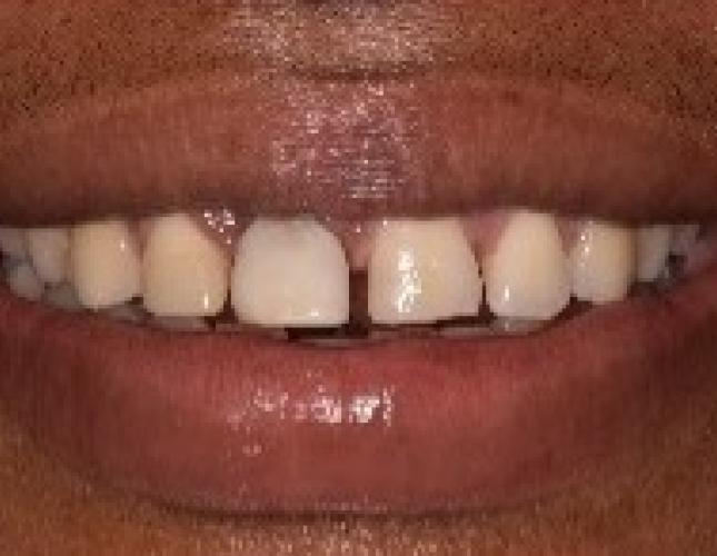 picture_10_before.jpg