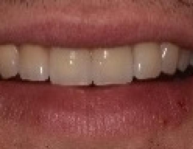 picture_12_after.jpg
