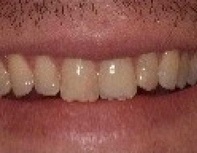 picture_12_before.jpg