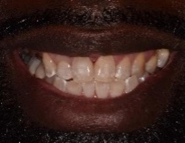 picture_3_after.jpg