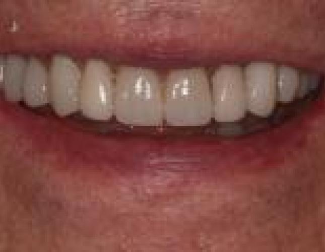 smile_makeover_-_after.jpg