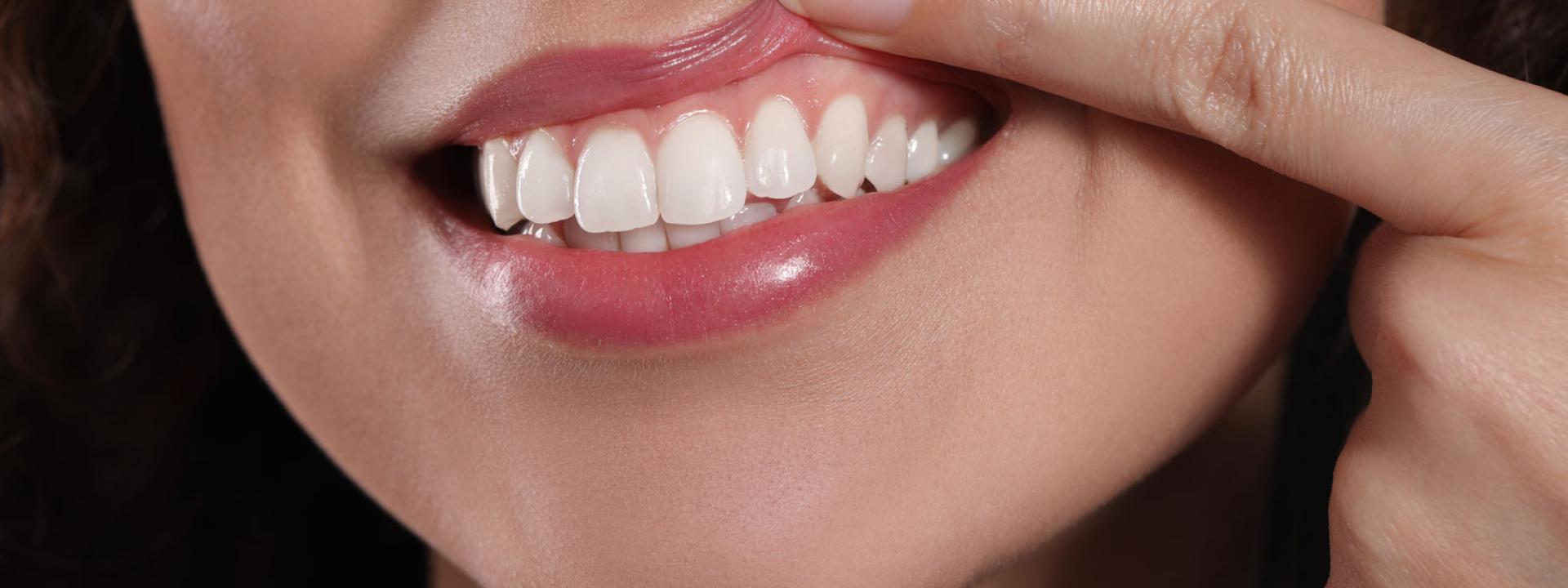 Healthy Gums